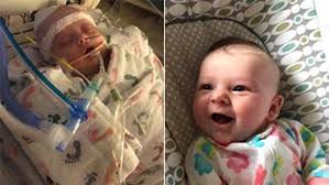 Newborn hit by softball being treated at Mayo Clinic, shows signs of  improvement