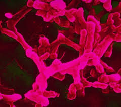 Image result for Typhoid Fever