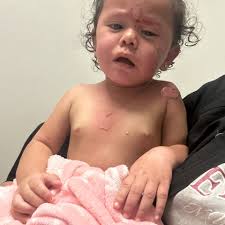 Fundraiser for Leslie Barron by Carina Barron : Support for Zenaida's Burn  Recovery