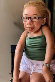 Birthday message for daughter with special needs