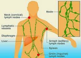 Elyana menghidapi kanser limfoma tahap 4. Juaini Bin Shaharain Apakah Itu Kanser Hodgkins Lymphoma