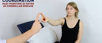 Image result for Cerebellar Function Test