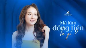 Má lúm đồng tiền là gì? Ý nghĩa tướng số của má lúm đồng tiền