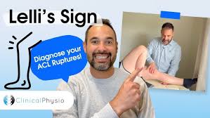 Image result for Lever Test