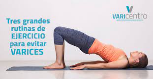 Las Tres Grandes Rutinas Para Evitar Varices Varicentro Tratamiento De Varices Sin Cirugia