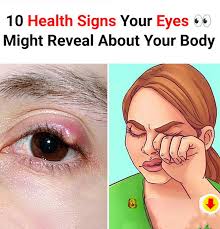 10 Health Signs Your Eyes Might Reveal About Your Body!..see more ..