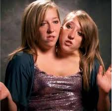 Les célèbres soeurs Siamoises Abby et Brittany Hensel. Les soeurs Abby et  brittany sont très connues dans le Royaume-Uni et le monde entier pour leur  particularité. Si leur cas étonné tant c'est