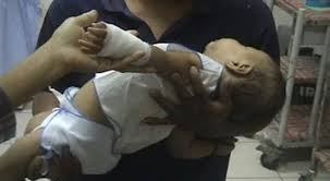Gambar foto tangan gemuk di infus paling imut hd download now koleksi animasi orang di infus kantor meme download now 30 foto tangan di infus asli di kamar. Bayi Yang Tangannya Nyaris Putus Segera Pulang Okezone News