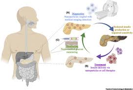 To buy used insulin pumps. Nanomedicine Based Strategies For Diabetes Diagnostics Monitoring And Treatment Sciencedirect