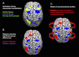 Thinking across the spectrum, in which she presents autism research from the fields of neurology and psychology. Brain Activation Scattering In Autism Autistic Individuals Show Less Download Scientific Diagram