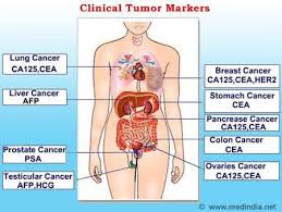 Whole List Of Tumor Markers And Their Sites Medical Laboratories Oncology Nursing Cancer Diagnosis Nursing Information