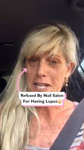 Nail salon refuses to serve customer for having lupus 😳💅