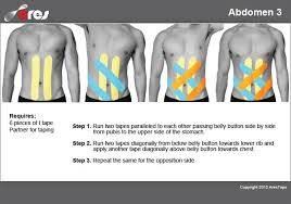 Abdomen 03 Ares Theratape Education Center Kinesiology Taping Abdomen Kinesio Taping