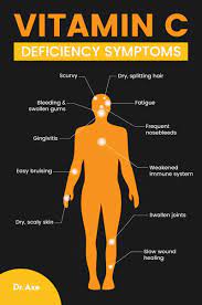 The Most Important Vitamin For Your Health Vitamin C Benefits Vitamin C Deficiency Symptoms Vitamin C Foods