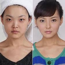Real Plastic Surgery Patients Who Are Unrecognizable At Airport Security Plastic Surgery Nose Surgery Extreme Plastic Surgery