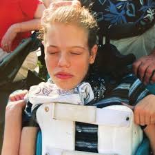 Rett Syndrome Externally-Led Patient-Focused Drug Development Meeting