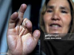 208 To Go With Story Of Afghanistan Unrest Children Stock Photos, High-Res  Pictures, and Images