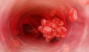 Causas de la trombosis o por qué se produce. Trombosis Venosa Profunda Tvp Sintomas Causas Y Tratamientos Panel De Salud