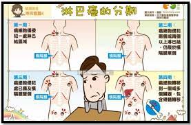 哪個細胞突變了？ b細胞型：較常見。罹患淋巴癌的犬貓中， 約有八成的狗和六成的貓是屬於此類型 。 t細胞型：雖然比例較低，但此類型的淋巴癌在治療上比較困難。 腫瘤長在哪？ å…'ç™Œå…'ç«¥æ·‹å·´ç˜¤ä»‹ç´¹ è‡ºä¸­æ¦®ç¸½å…¨çƒè³‡è¨Šç¶²taichung Veterans General Hospital