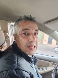 اعتداء مرتزقة المخزن على الصحفي محمد هيبة ميارة منسق إيكيب ميديا – DZ54