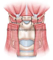 Image result for Hyoid Bone