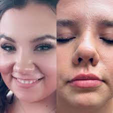 Created some lippies for this cutie!! 🫦😍 We used 1 syringe of Restylane  Refyne…focusing mostly