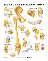 Hip Knee Chart Hip And Knee Inflammations Laminated Lfa 99781