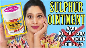 Using the wrong products · 5. Acne Spot Treatment That Actually Work Sulphur Ointment Minimizes Pimple In 2 Days Youtube