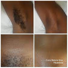 Brazilian wax before and after photos. Facebook