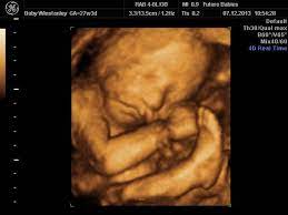 4d ultrasound pictures at 27 weeks. 3d Image Of A Baby At 27 Weeks Gestation Future Baby Ultrasound 10 Things