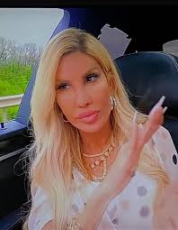 Sharon looks much better without those shots….