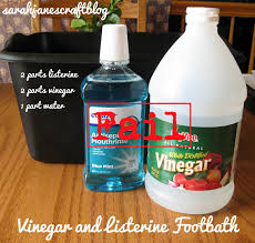 But after making a lot of researches, we came across that listerine is the best product. Sarah Jane S Craft Blog As Seen On Pinterest Vinegar And Listerine Foot Soak
