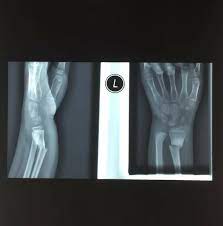 Masuk dengan sosial media tidak bisa digunakan dalam mode incognito dan privat. Bila Anak Patah Tangan Wawa Z Donut