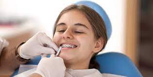 What goes into the passport application? Can Braces Be Removed Early