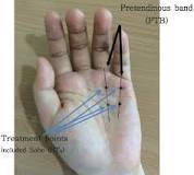 Image result