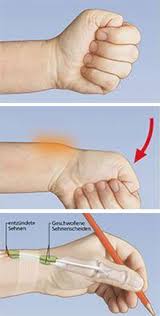 Handchirurgie Handfacts