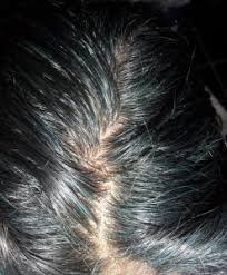 This indigo hair dye shade is so lovely. Blue Hair Streaks Purple Hair Dye Voyage Indigo Natural Hair Dye In Gray Hair And Blonde Hair Renaissance Henna