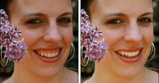 What causes a gummy smile? Pin On Photography Tips