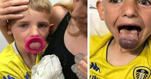 6-vuotias poika oli kuolla ja menettää kielensä juotuaan juomapullosta