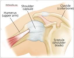 Image result for Shoulder Subluxation