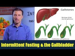 Pin On Intermittent Fasting