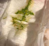 Ein grüner stuhl bei säuglingen mit künstlicher ernährung kann während der stillzeit für künstliche mischungen erscheinen. Hilfe Gruner Stuhlgang Vorsicht Bild Forum Baby Urbia De