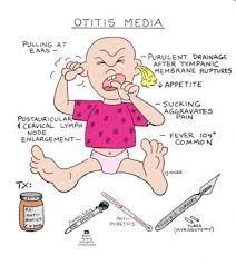 Otitis Media Pediatrics Pediatric Nursing Nursing Mnemonics Nursing School Survival