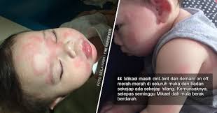 Jangan nak berahsia kalau anda pernah berak berdarah sebab simpton ini sebenarnya boleh mendatangkan kesan yang mudarat, malah belum tentu itu tanda buasir! Anak Muntah 9 Kali Sehari Muka Dan Badan Merah Merah Demam On Off Cirit Birit 11 Kali Sehari Ibu Kongsi Derita Anaknya Kesan Dari Minum Susu Tiruan Viral Purba