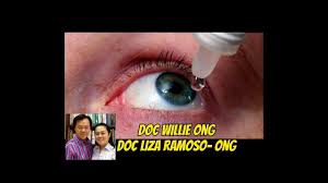 Dalam banyak kasus, sakit mata merah juga dapat menimbulkan gejala mata kering. Dry Eyes Nagluluha Parang May Buhangin Ni Doc Willie Ong 731 Youtube
