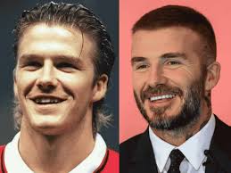 David Beckham's Teeth Changed Over the Years