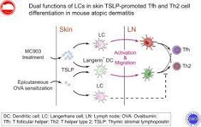 The olympic fever is high with us. Dual Function Of Langerhans Cells In Skin Tslp Promoted Tfh Differentiation In Mouse Atopic Dermatitis Journal Of Allergy And Clinical Immunology X Mol