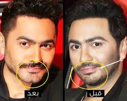 We did not find results for: Ø·Ø¨ÙŠØ¨ ØªØ¬Ù…ÙŠÙ„ ÙŠØ­Ø³Ù… Ø§Ù„Ø¬Ø¯Ù„ Ø­ÙˆÙ„ Ø§Ù„Ø¹Ù…Ù„ÙŠØ§Øª Ø§Ù„ØªØ¬Ù…ÙŠÙ„ÙŠØ© ÙÙŠ ÙˆØ¬Ù‡ ØªØ§Ù…Ø± Ø­Ø³Ù†ÙŠ Ø³Ù…Ø§ Ø§Ù„Ø¥Ø®Ø¨Ø§Ø±ÙŠØ©