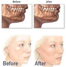 10 Best Cosmetic Surgery Images Plastic Surgery Surgery