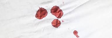 To remove a blood stain from your jeans, place a washcloth inside your jeans under the stain and blot the spot with a second clean cloth soaked in cold water. How To Remove Blood Stains From Clothes Cotton Cotton